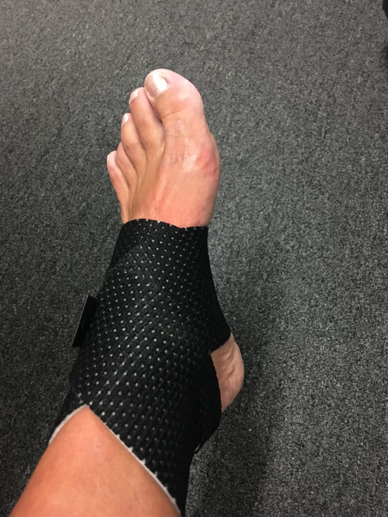 Stacy Sasnett Running Injur